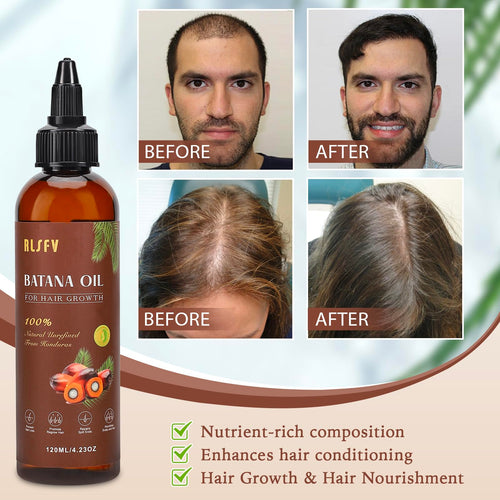 Batana Hair Growth & Nourishing Oil